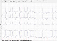 Cor pulmonale bei einem Wallach